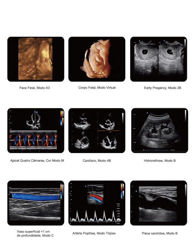 Ultrassom healthequipamentos