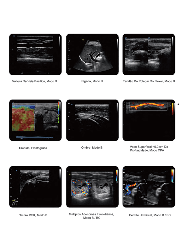 Ultrassom healthequipamentos