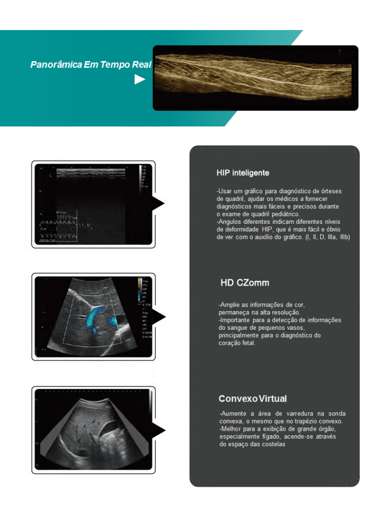 Ultrassom healthequipamentos