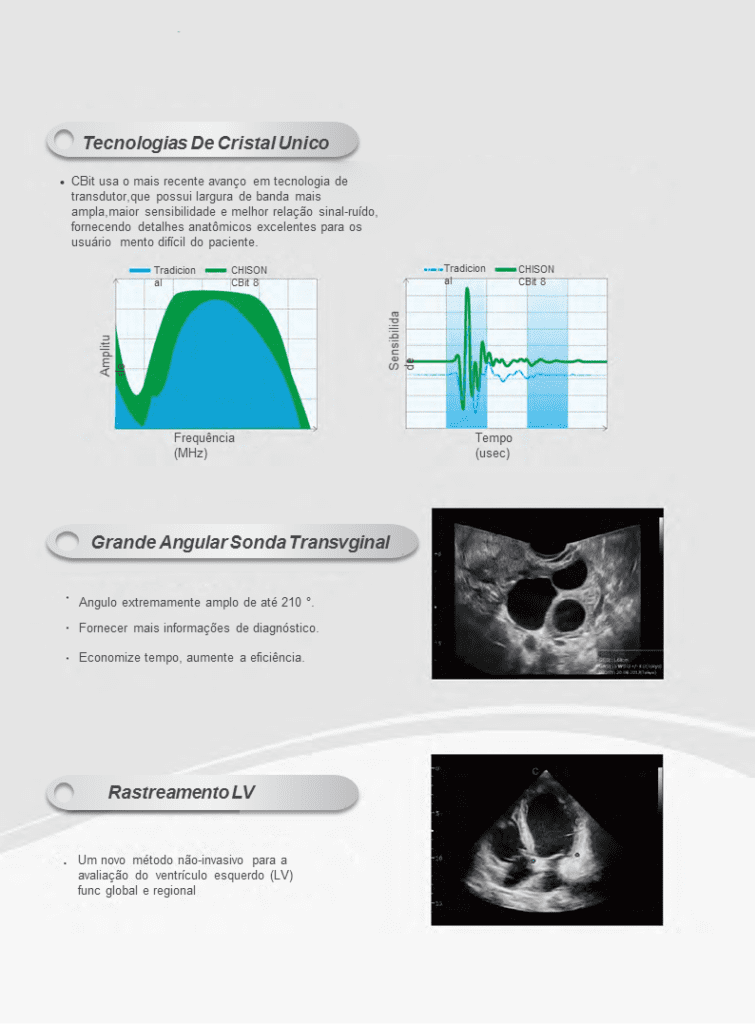 Ultrassom healthequipamentos