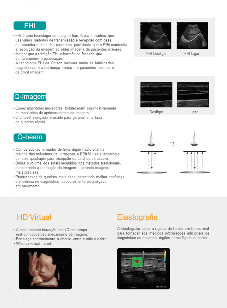 Ultrassom healthequipamentos