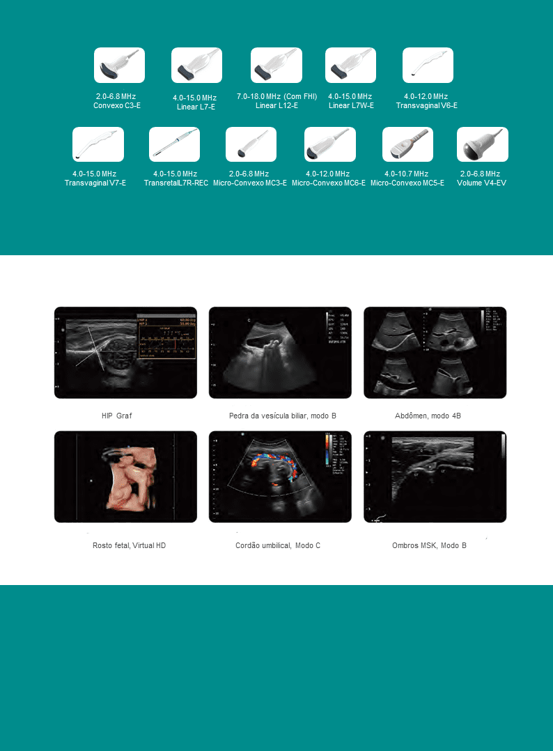 Ultrassom healthequipamentos