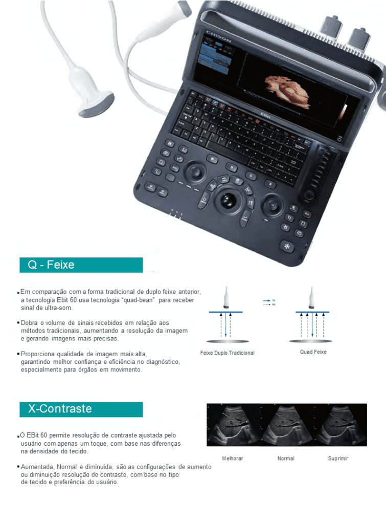 Ultrassom healthequipamentos