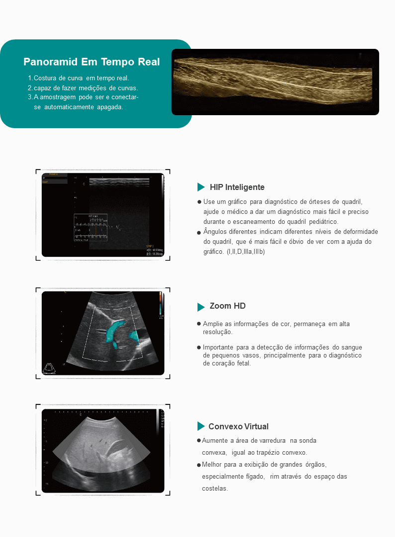 Ultrassom healthequipamentos