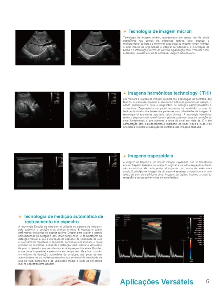 Sistema de ultrassom inteligente DW T30