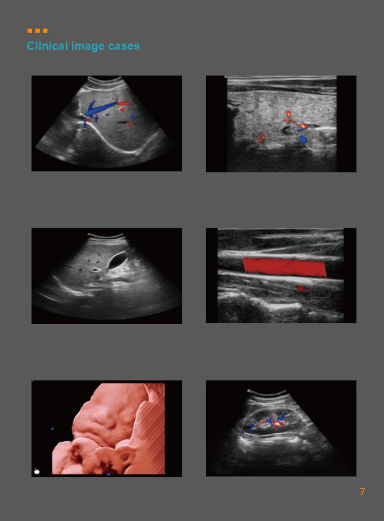 Sistema de ultrassom inteligente DW T30