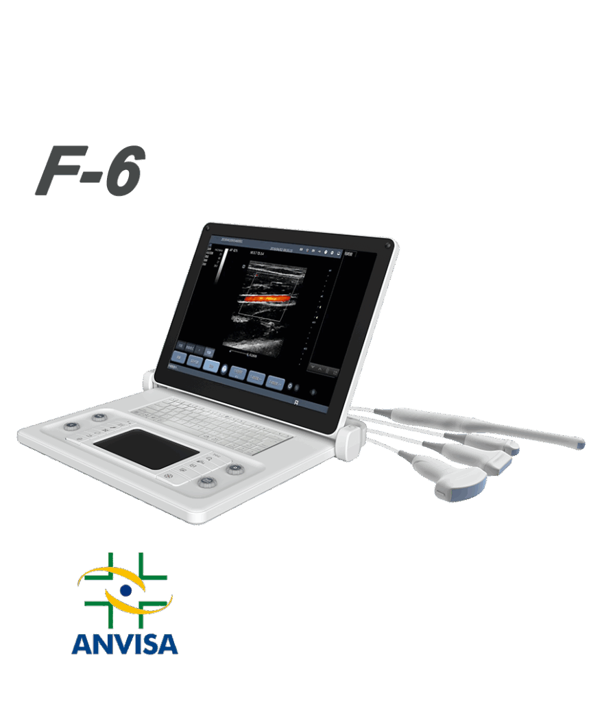 Sistema de ultrassom