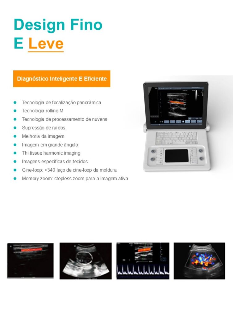 Sistema de ultrassom